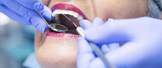 Best Urgent Care for Lost Fillings or Crowns in Willmsburg, IA